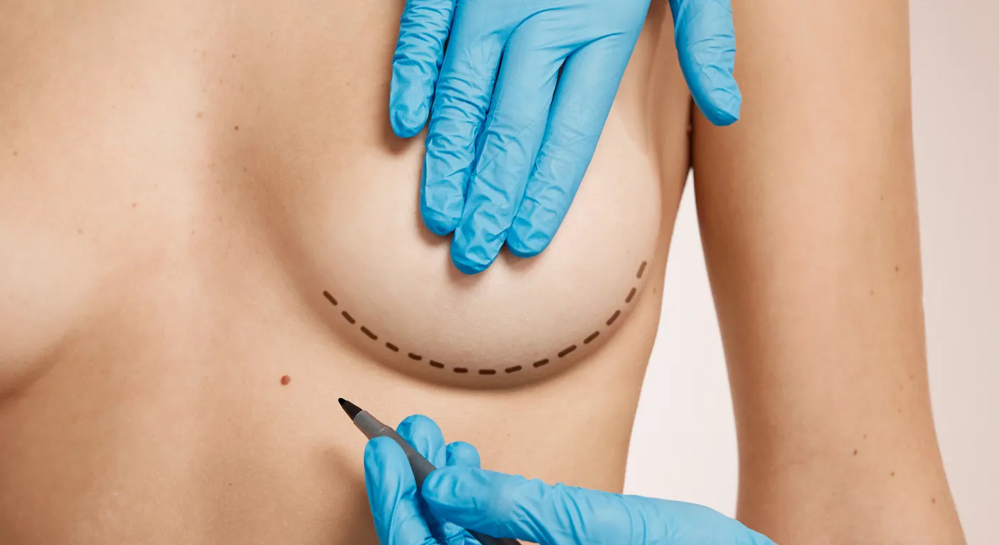 breast surgery
